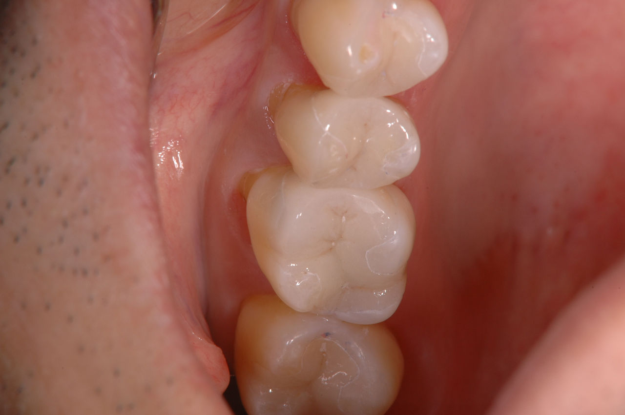 D0658004