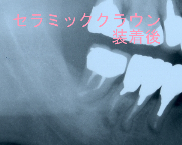 BlogPaint