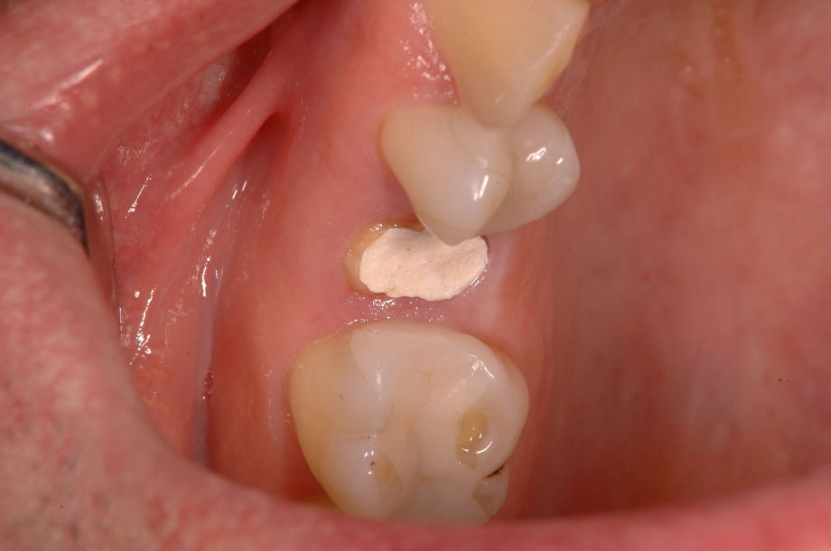 D0755002